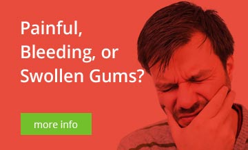 Painful bleeding or swollen gums