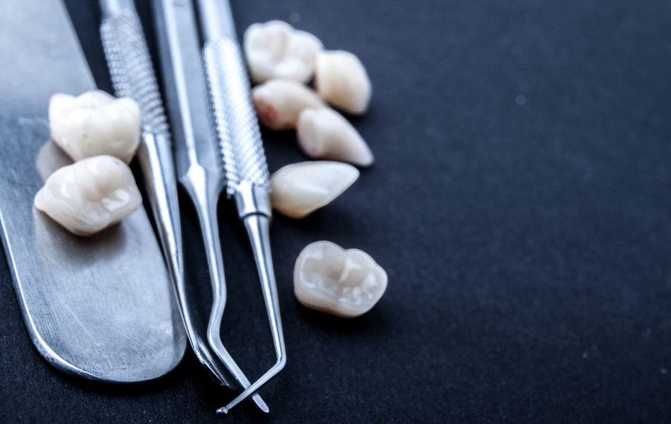 Dental Crowns and Bridges
