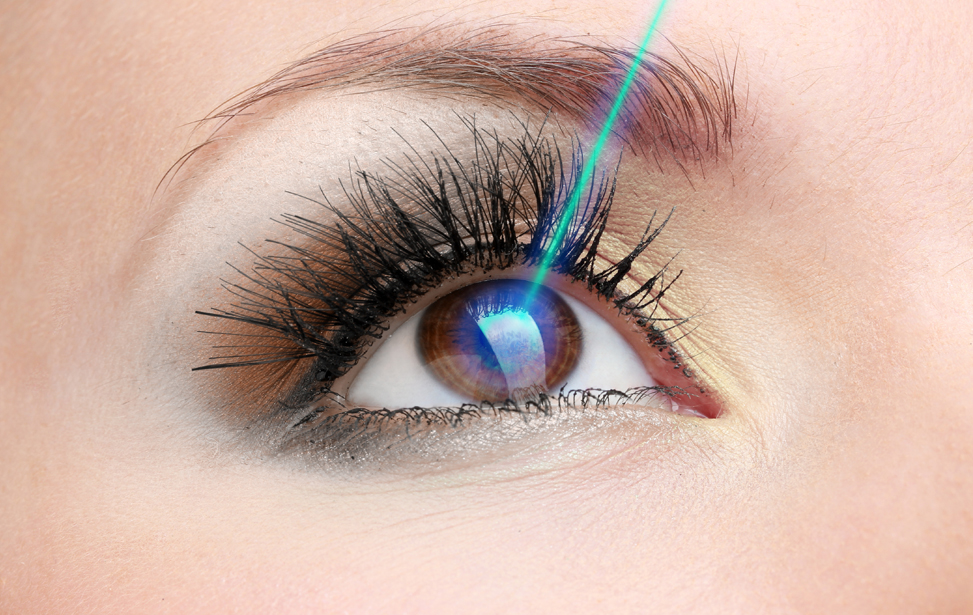 Lasik Eye Surgery